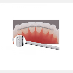 Retainer Wire SS