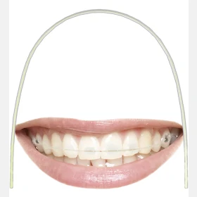 3B ORTHO-COATED NiTi Archwires