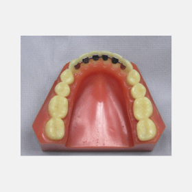 Lingual  Retainer-Dondable