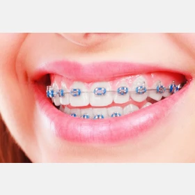 GNI-Ligature tie-1040pcs/pk