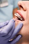 Orthodontics