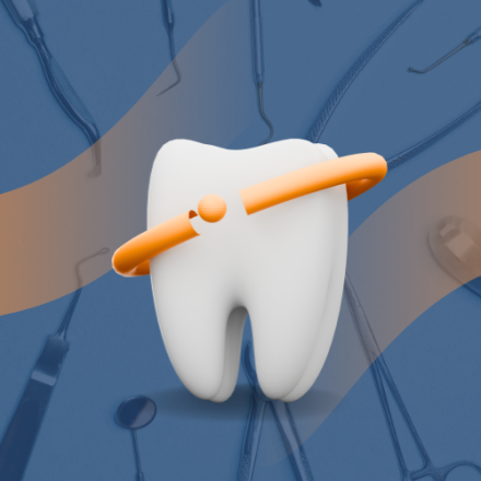 Resin Brackets